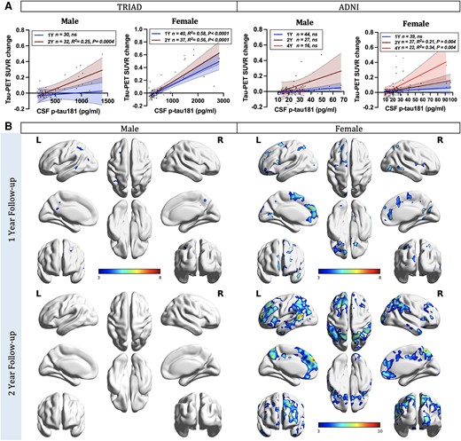 CSF phosphorylated-tau predicts tau accumulation in females. (A) Sex-disaggregated linear regression analyses were performed in both TRIAD and ADNI cohorts to examine the differences between sexes in the relationships between CSF phosphorylated tau-181 (p-tau181) concentrations and the longitudinal accumulation of neurofibrillary tangles (NFTs), as indicated by changes in tau-PET standardized uptake value ratios (SUVRs). In the TRIAD cohort, two follow-up time points were evaluated. Females displayed positive correlations between baseline CSF p-tau181 concentrations and NFT accumulation at both 1-year (P < 0.0001, R2 = 0.58) and 2-year (P < 0.0001, R2 = 0.56) follow-up visits. In contrast, males only exhibited positive associations at the 2-year follow-up assessment (P = 0.0004, R2 = 0.25). In the ADNI cohort, three follow-up time points were assessed. Females demonstrated positive correlations between baseline CSF p-tau181 concentrations and NFT accumulation at 2-year (P = 0.0004, R2 = 0.21) and 4-year (P = 0.0004, R2 = 0.34) follow-up visits. Conversely, males did not exhibit any such associations. (B) Sex-disaggregated voxel-based analyses demonstrated that the concentration of p-tau181 in the CSF at the baseline was positively associated with longitudinal NFT accumulation in females. In contrast, males presented almost no association. Images represent voxel-based t-statistical parametric maps overlaid on the structural MRI reference template. Age, APOE ε4 carriage status and pathological status were used as covariates in the models. Results were also corrected for multiple comparisons using a false discovery rate (FDR) cluster threshold of P < 0.001. ADNI = Alzheimer’s Disease Neuroimaging Initiative; L = left; R = right; TRIAD = Translational Biomarkers in Aging and Dementia.