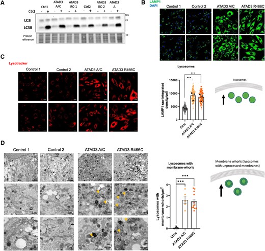 ATAD3 dysfunction increases lysosome numbers maintaining autophagic flux. (A) ATAD3 A/C, deletion (Δ) and R466C cells were treated with and without chloroquine (CLQ), to block autophagy, in parallel with control cells (Ctrl). Lipidated LC3 (LC3II) was detected by immunoblotting after fractionating whole cell lysates via SDS-PAGE. (B) Top: ATAD3A mutant and control fibroblasts stained with an antibody against lysosome-associated membrane protein 1 (LAMP1, green) with DAPI (blue) stained nuclei. Bottom: Chart of LAMP1 signal (measured as raw integrated density per cell) from controls and ATAD3 mutant fibroblasts (>100 cells per line, n = 3 independent experiments). Scale bar = 30 µm. Differences between groups were analysed by unpaired, two-tailed Student’s t-test (Controls versus ATAD3 A/C, ***P < 10−7) and unpaired, two-tailed Mann-Whitney U-test (Controls versus ATAD3 R466C, ***P < 10−7). Cartoon illustrates the increase in the lysosomal pool. (C) ATAD3 mutant and control fibroblasts stained with an indicator of acidified lysosomes, Lysotracker Red. (D) Left: Transmission electron micrographs of ATAD3 mutant and control fibroblasts showing cytoplasmic content at different magnifications. Note the many structures with membrane whorls that are characteristic of lysosomal storage diseases, some of which are arrowed. Right: The chart indicates as dots the number of lysosomes with membrane -whorls in an area of 13.554 µm2 in micrographs of ×2500 magnification. Differences between groups were analysed by unpaired, two-tailed Student’s t-test (Controls versus ATAD3 A/C, ***P = 5 × 10−9) and unpaired, two-tailed Mann-Whitney U-test (Controls versus ATAD3 R466C, ***P = 7.4 × 10−7). The accompanying cartoon illustrates the accumulation of lysosomes with membrane-whorls in the ATAD3 mutant cells.