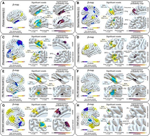 Support vector regression-based lesion–symptom mapping results. (A) Picture naming task (left-sided tumours, n = 223). (B) Semantic fluency task (left-sided tumours, n = 223). (C) Phonological fluency task (left-sided tumours, n = 220). (D) Stroop naming task (left-sided tumours, n = 114). (E) RL-RI free recall task (left-sided tumours, n = 93). (F) RL-RI total recall task (left-sided tumours, n = 93). (G) Bell test (right-sided tumours, n = 155). (H) TMT-A task (right-sided tumours, n = 122). In each panel, raw β-maps are on the left, significant voxels are in the middle (ROIa are displayed in blue, ROIb in yellow, with the used hyperparameters displayed underneath), and supra-tumour probability maps within suprathresholded voxels are on the right. Statistical P-maps are derived from a 10 000 permutation-based procedure. ROIa were obtained after continuous permutation-based familywise error correction set at P < 0.05 (V = 10), i.e. the conservative approach. ROIb were obtained using P < 0.001 uncorrected voxelwise and P < 0.05 clusterwise, i.e. the lenient approach. Importantly, no voxels with positive β-values were found to survive statistical thresholding when negative β-values predicted behaviour worsening (A–C, E and F) and, conversely, no voxels with negative β-values were found to survive statistical thresholding when positive β-values predicted behaviour worsening (D, G and H). Cing = cingulate; IPL = inferior parietal lobule; ITG = inferior temporal gyrus; L = left-sided tumours; MFG = middle frontal gyrus; MTG = middle temporal gyrus; parahip = parahippocampal gyrus; post-CG = post-central gyrus; R = right-sided tumours; RL-RI = rappel libre–rappel indicé; ROI = region of interest; SFG = superior frontal gyrus; TMT = Trail Making Test.