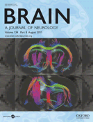 Dopamine-dependent reinforcement of motor skill learning: evidence from Gilles de la Tourette syndrome