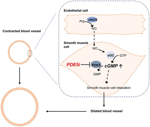 Proposed model of PDE5i on cerebral blood vessels with endothelial dysfunction. The figure shows a cross-section of a contracted and dilated blood vessel. The dashed box demonstrates the interaction between the endothelial cell and the vascular smooth muscle cell. In endothelial dysfunction, a reduced amount of NO is produced by endothelial cells, leading to reduced cGMP concentration in the vascular smooth muscle cell. PDE5i limit the breakdown of cGMP and, therefore, increase cGMP concentration within the smooth muscle cell and further lead to smooth muscle cell relaxation, dilation of the blood vessel and increased blood flow. The following graphic explanations apply: stimulates (line with arrow ), inhibits (line with bar ) and stimulates indirectly (dashed line with arrow ). Arg: arginine; eNOS: endothelial nitric oxide synthase; GMP: guanosine monophosphate; GTP: guanosine triphosphate; sGC: soluble guanylyl cyclase.