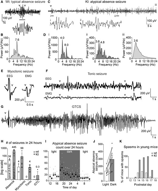 Spontaneous seizures were observed in adult KI mice. Representative EEG traces for typical absence seizures seen in wild-type mice, and atypical absence, myoclonic, tonic and GTCS seen in KI mice. The arrowheads indicate the start and end of the seizure. Note that the atypical absence seizure extends beyond the selected time frame, so no endpoint is shown. (A) Typical absence seizures in wild-type mice were brief and behavioural arrest was time-locked to SWD onset and offset. (B) Power spectral density for typical absence seizure EEGs in wild-type mice with peak frequency at 7.6 Hz. (C) Atypical absence seizure EEG trace; atypical absence seizures were not always time-locked with the behavioural onset and/or had brief movements during the seizure (see Video 1 for full seizure). (D) Power spectral density of atypical absence EEGs often started with (i) higher-frequency components that (ii) decreased over time; however, the frequency over the entire seizure (iii) was low. (E) Myoclonic seizure EEG discharges were brief (∼300 µs), and both EEG and EMG traces had prominent spikes. (F) EEG during tonic seizures did not stand out from the baseline in amplitude but showed an increased frequency compared with the baseline. (G) GTCS EEGs were striking with the largest increase in EEG amplitude. The tonic phases during GTCS had slightly lower amplitude but higher waveform frequencies compared with the clonic phase, which was followed by electrodecrement (see Video 1 for examples of KI video-EEG recordings for each seizure type). (H) Bar graph showing average number seizures in wild type and KI mice in a 24-h period (note: y-axis is log scale). Atypical absence seizures and myoclonic seizures were the dominant seizures in KI mice. (I, J) Most atypical absence seizures in KI mice occurred during the dark (active) period with a peak incidence at the light-to-dark period transition (paired t-test, n = 7, light mean = 142, dark mean = 297.7, *P = 0.011). As the light cycle does not change with daylight savings, all times are set to the appropriate non-daylight savings time (6:00–18:00 light, 18:00–6:00 dark). Video-EEG recordings (for panels A–J) were done in n = 4 wild type (two males, two females) and 7 KI (three males, four females) mice at age 4.5–6.5 months. (K) Spontaneous spasms in wild type and KI mice were observed in pups between P12 and P18. Shown are the percentages of wild type and KI pups that exhibited spasms at each age. Observers were blind (five litters, with n = 16 wild type and n = 19 KI mice).