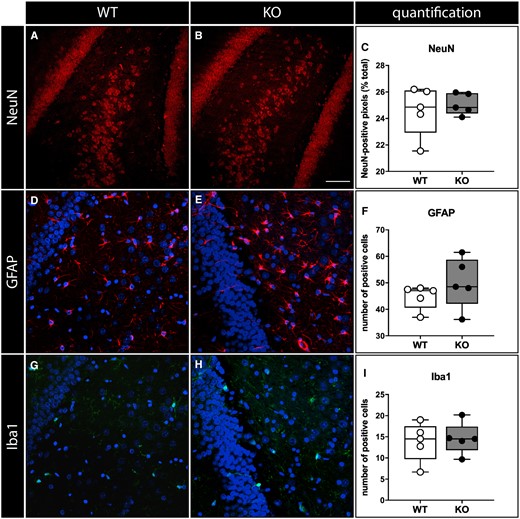 Immunohistochemical analysis. Neurons (A–C), labelled in red with a NeuN antibody, astrocytes (D–F, labelled in red with a GFAP antibody), microglial cells (G–I, labelled in green with an Iba-1 antibody). Shown are representative sections of the dentate gyrus area from naïve WT (A, D, G) and SESN3-KO rats (B, E, H). DAPI staining in blue. Data quantification in C, F, I. In all panels, open circles represent WT and solid circles represent SESN3-KO rats. Horizontal bar in panel B (for all panels) = 100 µm.