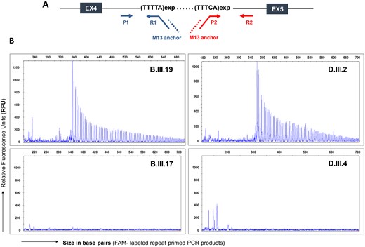 Identification of the TTTCA expanded repeats in families affected with ADCME. (A) Schematic representation of exons 4, 5 and intron 4 of the SAMD12 gene. The primer sets P1, R1 and M13 anchor were designed to amplify the TTTTA repeats, whereas, P2, R2 and M13 targeted the TTTCA repeats. (B) Representative images of RP-PCR analysis targeting (TTTCA)n repeats. The RP-PCR analysis showed the TTTCA repeat expansion in ADCME affected individuals (B.III.19 and D.III.2) whereas, the TTTCA repeats were absent in unaffected individuals from both the families (B.III.17 and D.III.4).