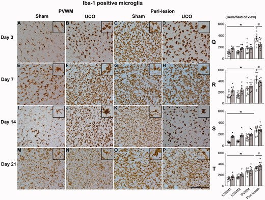 Microglia in non-cystic regions. Left panels (A−P): representative photomicrographs of Iba-1-positive microglia in the PVWM (parietal lobe) and peri-lesion region (temporal lobe). Inserts show higher magnification of microglial morphology. Note the profound morphology and density changes between sham and UCO groups, especially in the peri-lesion region at 3 days (C versus D) and 14 days (K versus L). All images were taken at ×40 magnification (inserts are additional ×2 magnification). Scale bar = 100 µm. Right panels (Q-T): numbers of Iba-1-positive microglia after sham occlusion (white columns) and UCO (grey columns). Three-way ANOVA including time, group and the three regions (IGWM1/2 and PVWM) as repeated measures showed a significant reduction in Iba1 positive microglia in the UCO groups within the parietal lobe regions (P < 0.05). Statistical significance shown on the figure was determined on individual time-points by one-way ANOVA for the peri-lesion region (#P < 0.05 sham versus UCO) and two-way ANOVA for the parietal lobe with area (IGWM1/2 and PVWM) as a repeated measure (*P < 0.05 sham versus UCO). Data are means ± SEM. N = Sham/UCO, Iba-1: 3d 9/8, 7d 8/8, 14d 9/8, 21d 9/8.