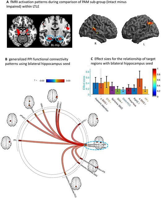 Sub-group comparison (Intact minus Impaired) within LTLE. (A) Whole brain surface rendering and slices revealing significant activation (SME minus Math contrast) resulting from t-test of sub-group difference (intact minus impaired) within the LTLE patients (PFDRt-statistic corrected, <0.05, cluster level). Results highlight the areas where the SME/Math difference is significantly larger in the LTLE patients with intact compared to impaired performance levels on the PAM task. (B) FC results of gPPI using bilateral hippocampal region emerging from the t-test effect (see A) as seed. Seed clusters of left (MNI coordinates of maxima: −20 –24 −18; 75 voxels) and right (14 –22 14; 72 voxels) hippocampus, involving the time course of the SME minus Math contrast was extracted and the generated gPPI regressor effects (gPPI_β) are displayed. Results revealed 10 target regions with functional relationship of statistically significant strength with combined hippocampal seed (PFDRt-statistic corrected < 0.05). (C) Bar diagram presented effect size (mean beta weights from gPPI) for each functional relationship between the source seed (combined left and right hippocampus) and target regions.