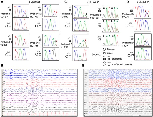 Dravet syndrome patient phenotypes. Pedigree and segregation analysis in nine Dravet syndrome patients of the nine GABR missense variants identified in (A) GABRA1, (C) GABRB2 and (D) GABRG2. Arrows indicate the position of the variant in the Sanger chromatograms of the affected probands. (B) Representative EEGs recorded during a seizure at 7 years of age of proband 1 showing high amplitude spike-wave discharges in the left occipital leads. (E) Representative EEG recorded during a seizure at 12 years of age of proband 9 showing generalized spike waves.