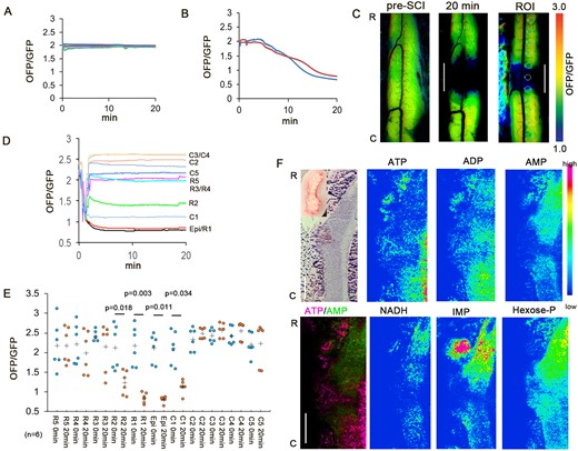 Real-time monitoring of intracellular ATP. (A) Colour traces represent the OFP/GFP ratio in the normal spinal cord (n = 5). (B) Red and blue traces represent the OFP/GFP ratio in the normal spinal cord after cardiac circulation arrest (n = 2). (C) Representative intracellular ATP images at pre-SCI and 20 min after SCI. The maximum OFP/GFP value at 3.0 and the minimum value at 1.0. The right panel shows the ROI. Scale bar = 2 mm. (D) Intracellular ATP reduction on the rostral side of the injury. Colour traces represent the mean OFP/GFP ratio after decompression (n = 6). (E) Intracellular ATP level before SCI (pre-SCI) and 20 min after SCI. Plus marks represent the mean. (n = 6). (F) MS findings at 20 min after SCI (n = 4). The caudal side had a high ATP level. The NADH, hexose phosphate, and IMP levels were high on the rostral side. 2,3-Diphosphoglyceric acid (2,3-DPG) was observed at the injury site. NADH, nicotinamide adenine dinucleotide; IMP, inosine5′-monophosphate; Hexose-P, hexose phosphate; R, rostral. C, caudal. Data were analysed using Wilcoxon’s signed-rank test and the Kruskal–Wallis test along with Dunn’s post hoc test. Scale bar = 1 mm.