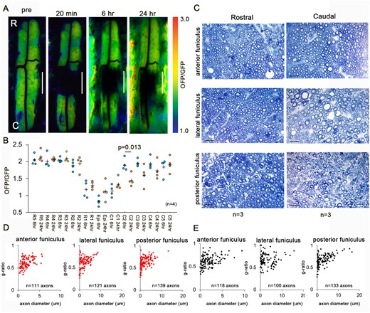 Rostro-caudal differences in degeneration in early SCI after 2-DG treatment. (A) Representative intracellular ATP images before and 20 min, 6 h, and 24 h after SCI with 2-DG administration. (B) The intracellular ATP levels at 6 and 24 h after SCI. The maximum OFP/GFP value at 3.0 and the minimum value at 1.0. Data were analysed using Wilcoxon’s signed-rank test and the Kruskal–Wallis test along with Dunn’s post hoc test. Plus marks represent the mean. (n = 4). (C) Representative images in white matter cross-sections 24 h after SCI at 3 mm rostral and caudal from the epicentre. Scale bar = 10 um. (D and E) Scatterplot of g-ratio versus axon diameter in white matter cross-sections at 3 mm rostral (D) and caudal (E) from the epicentre. (n = 3). Data were analysed using Wilcoxon’s signed-rank test and the Kruskal–Wallis test along with Dunn’s post hoc test.