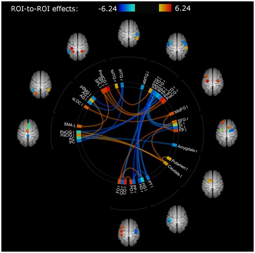 Connections showing differences in functional connectivity between healthy and stroke participants at baseline (T1) with mean FD as regressor of no interest. Colour of lines and ROIs indicate strength of difference in functional connectivity: Blue (lower connectivity, lowest z-transformed r value: -6.24) to red (higher connectivity, highest z-transformed r value 6.24) in stroke participants compared with healthy controls. Abbreviations of region of interest (ROI) labels can be found in Table 1. A detailed overview of involved connections and their strengths can be found in Supplemenatry Tables 3a (for hypoconnected regions) and 3b (for hyperconnected regions).