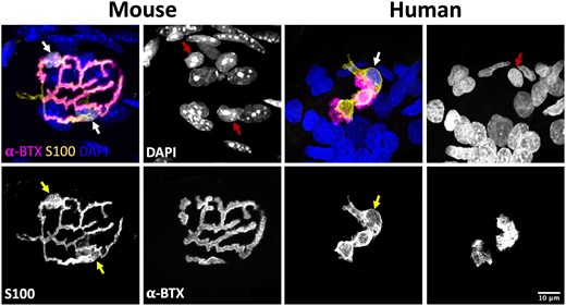 Terminal Schwann cells at the mouse and human neuromuscular junction. Representative confocal micrographs of mouse and human NMJs. Merged images show tSCs (yellow), AChRs (magenta) and nuclei (blue). tSC nuclei (red arrows) are identified by the surrounding halo of S100 cytoplasm (yellow arrows). Note how mouse tSCs closely mirror their corresponding AChR profiles; human tSCs show much less congruence, including non-synaptic cytoplasm that does not directly overlie the motor endplate. Terminal Schwann cells (tSCs) labelled with S100 (yellow); acetylcholine receptors (AChRs) labelled with α-BTX (magenta); nuclear staining with DAPI (blue). Scale bar = 10 µm across all the images.