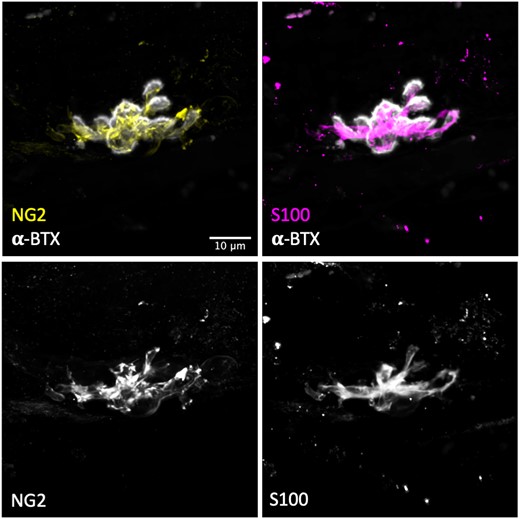 S100 is a reliable marker for human tSCs. Representative confocal micrographs of human tSCs from the PB muscle with double immunolabelling to show co-localization of anti NG2 (yellow) and anti-S100 (magenta), confirming that S100 is an accurate marker for human tSCs. Both markers (S100-magenta) and (NG2-yellow) showed similar staining patterns and revealed similar tSC morphology. S100 staining was found to be more intense and more evenly distributed within the cell (particularly within the tSC cytoplasm). Acetylcholine receptors (AChRs) labelled with α-BTX (grey). Scale bar = 10 µm across all images.