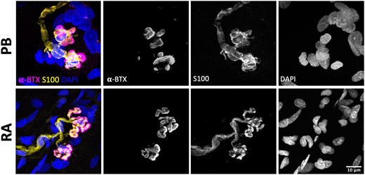 Consistent tSC morphology across different human muscles. Representative confocal micrographs of human NMJs obtained from PB (peroneus brevis; top panels) and RA (rectus abdominus; bottom panels). PB muscle samples were harvested from patients undergoing lower limb amputation; RA muscle biopsies were obtained from patients undergoing abdominal surgery. tSCs had a very similar appearance in both muscles, suggesting that the morphology reported in PB samples was not related to body region, patient pathology, and/or sampling technique. Merged images show terminal Schwann cells (tSCs) labelled with S100 (yellow), acetylcholine receptors (AChRs) labelled with α-BTX (magenta), and nuclear staining with DAPI (blue). Scale bar = 10 µm across all images.