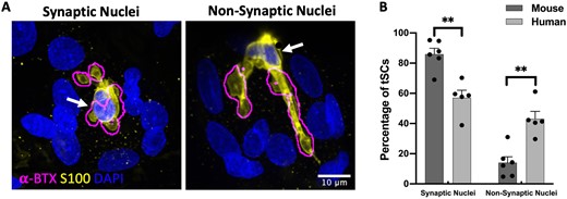 Location and placement of nuclei in human terminal Schwann cells. (A) Representative micrographs of human NMJs illustrating ‘synaptic’ and ‘non-synaptic’ placement of tSC nuclei (yellow: tSC/S100, blue: nuclei/DAPI). The ‘Find Edges’ function in ImageJ/FIJI was applied to the magenta channel (AChRs/alpha-BTX) to define the boundaries of the AChRs (methods acquired from Carrasco et al.23). The location of tSC nuclei is indicated by the white arrows. (B) Although the vast majority of mouse tSCs had a ‘synaptic’ placement of their nuclei (∼80%), human tSCs revealed a more even balance of ‘synaptic’ (∼60%) and ‘non-synaptic’ (∼40%) nuclei. Note also the ‘annular’ arrangement of myonuclei around the human NMJ. Bar charts are mean ± SEM; each data point represents an individual muscle; mouse: N = 6; n = 214 tSCs; human: N = 5; n = 247 tSCs. Mann–Whitney test for non-parametric variables. **P ≤ 0.01. Scale bar = 10 µm in both images.