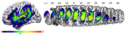 Lesion overlap map. The colour scale ranges from 4 lesions (minimum for inclusion in SVR-LSM analyses) to 21 (maximum overlap). Coordinates refer to z-values in MNI-space.