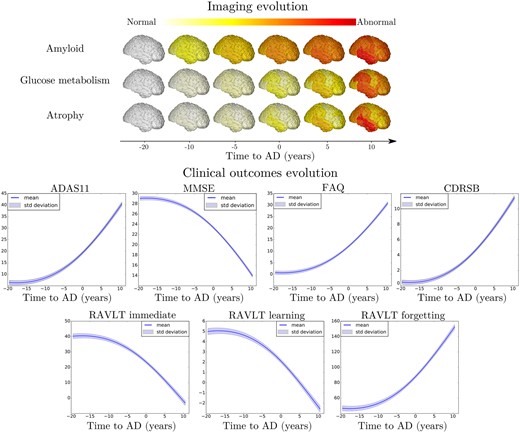 Model-based progression of Alzheimer’s disease. Estimated long-term evolution of cortical measurements for the different types of imaging markers, and clinical scores. Shadowed areas represent the standard deviation of the average trajectory. Brain images were generated using the software provided in Marinescu et al.61