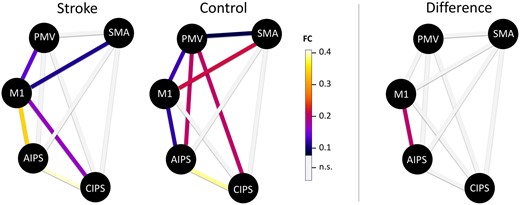 Functional connectivity of the ipsilesional hemisphere. Coloured lines indicate significant coupling estimates for each group (left; P < 0.05, FDR-corrected for 20 tests over both groups) or significant absolute group difference for AIPS-M1 (right; P < 0.05, FDR corrected for 10 tests).