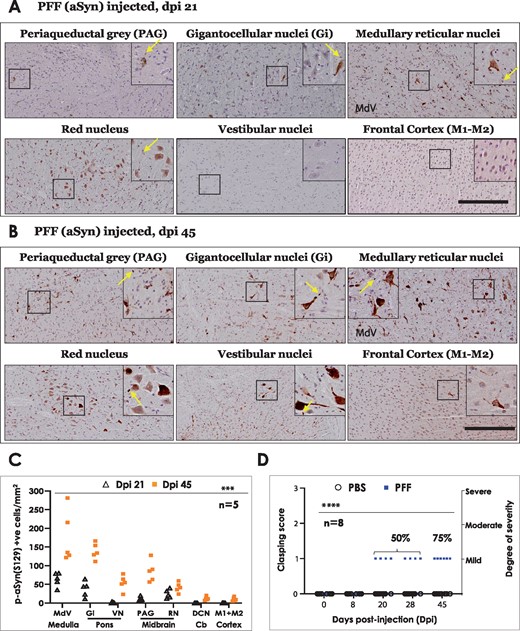 Immunostaining of phospho-alpha synuclein (S129) in brain regions of PFF aSyn injected M83+\+ mice and assessment of hindlimb clasping behaviour. (A–B) Representative images showing p-aSyn (S129) IHC in indicated brain regions at dpi 21 (A) and dpi 45 (B) (dpi, days post-injection; 10× magnified views, scale bar = 200 µm). Yellow arrows in the insets point to select instances of p-aSyn (S129) positive oligodendroglial cells in the vicinity of neurons. Also see Supplementary Fig. 2A–B (representative images from PBS injected- dpi 45 and PFF aSyn injected- dpi 14 cohorts) and Supplementary Fig. 3A (5× low magnification images annotated with neuroanatomical landmarks, PFF aSyn injected- dpi 45). Primary antibody in A–B: p-aSyn (S129)- 11A5. (C) Semi-quantitative analyses of p-aSyn (S129) immunopositive cells in the indicated brain regions at dpi 21 and dpi 45 in PFF injected M83+/+ mice. Individual data point represents p-aSyn (S129) cell counts/mm2/region in each animal of the respective cohort, with dpi 21 being depicted as blank triangles and dpi 45 as the orange squares. (MdV, medullary reticular nuclei; Gi, pontine gigantocellualr nuclei; VN, pontine vestibular nuclei; PAG, periaqueductal grey matter; RN, red nucleus, DCN- crb, deep cerebellar nuclei; M1+M2, primary and secondary motor cortex; One-way ANOVA, Kruskal–Wallis test- p.0002, n = 5/group; dpi, days post-injection). (D) Hindlimb clasping assessment in PBS and PFF aSyn injected cohorts, with individual data points representing clasping score of each animal in the respective cohort. Notice that PBS injected mice do not exhibit hindlimb clasping (blank circles, score = 0). The PFF injected mice start show mild clasping around dpi 21–28 and later (blue squares; 4 animals at dpi 21–28 and 6 animals at dpi 45). Two-way ANOVA (alpha 0.05- P < 0.0001; n = 8/group).