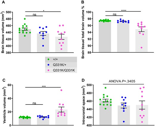In vivo MRI reveals global brain volume loss and ventricular enlargement in 7-month-old TDP-43Q331K/Q331K knock-in mice. (A) Quantification of brain parenchyma volume. ANOVA P = 0.0191. Pairwise comparisons: +/+ versus Q331K/+: ns P = 0.1159; +/+ versus Q331K/Q331K: * P = 0.0115. (B) Quantification of brain parenchyma volume as a percentage of total brain volume. ANOVA P < 0.0001. Pairwise comparisons: +/+ versus Q331K/+: ns P = 0.7448; +/+ versus Q331K/Q331K: **** P < 0.0001. (C) Quantification of ventricle volume. ANOVA P = 0.0003. Pairwise comparisons: WT (+/+) and TDP43Q331K/+ (Q331K/+): ns P = 0.8597; WT (+/+) and TDP43Q331K/Q331K (Q331K/Q331K): *** P = 0.0004. (D) Quantification of brain parenchyma volume and ventricular volume combined. ANOVA P = 0.3405. (A–D) Each dot represents one mouse. Groups were compared by one-way ANOVA followed by Holm–Sidak post hoc test for pairwise comparisons; error bars represent mean ± SEM.