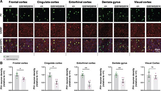 Parvalbumin neuron density is reduced in MRI regions of interest in 7-month-old TDP-43Q331K/Q331K mice. (A) Representative images showing parvalbumin (PV) staining, GAD67 staining, and DAPI (blue) in indicated regions of 7-month-old WT (+/+) and TDP43Q331K/Q331K (Q331K/Q331K) mouse brains. (B) Quantification of PV+ interneuron density in given brain regions. Each dot represents one mouse. Comparisons between WT and TDP43Q331K/Q331K as follows: frontal cortex * P = 0.0186; cingulate cortex, * P = 0.0107; entorhinal cortex, ** P = 0.0026; dentate gyrus, ** P = 0.0074; visual cortex, P = 0.4742 (ns, not significant). P-values were calculated with multiple t-tests adjusted by Holm–Sidak correction. Error bars represent mean ± SEM.