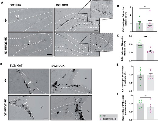 Aberrant neurogenesis in TDP-43Q331K/Q331K mice. (A) Immunohistochemistry showing cell division marker Ki67 (arrow heads) and immature neuron marker DCX in the mouse hippocampal dentate gyrus of 7-month-old +/+ and Q331K/Q331K mice. Scale bar, 40 and 100 μm, representatively. (B) Quantification of Ki67+ cells per dental gyrus (DG) section in hippocampus between +/+ and Q331K/Q331K mice: ns P = 0.9183. (C) Quantification of DCX+ cells per DG section in the hippocampal dentate gyrus between +/+ and Q331K/Q331K mice: *** P = 0.0008. (D) Representative images showing cell division marker Ki67 (arrow heads) and immature neuron marker DCX in the mouse subventricular zone with (E, F) quantification. Comparisons between +/+ and Q331K/Q331K as follows: Ki67, ns P = 0.8820; DCX, ns P = 0.1794. V = lateral ventricle. (B, C, E, F) Each dot represents one mouse. Groups were compared by unpaired two-tailed t-test. All data shown are mean ± SEM.