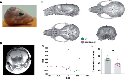 Altered skull shape in TDP-43Q331K/Q331K mice. (A) Photo of scalped head of a Q331K/Q331K mouse and (B) ex vivo MRI scan of fixed head of the mouse. (C) Geometric morphometric analysis of +/+ versus Q331K/Q331K mice. Average landmark configurations of +/+ and Q331K/Q331K skulls superimposed on +/+ average skull, showing (clockwise from top left) lateral, superior, rear and inferior views. Each dot represents a single standardized landmark, the colour indicating the average for each genotype. (D) Principal component analysis (first two components) of skull shape variation after scaling. (E) Centroid sizes (the square root of the sum of the squared distances of a set of landmarks from their collective centroid) of +/+ and Q331K/Q331K skulls. Groups were compared by unpaired two-tailed t-test: ** P = 0.0022. Error bars represent mean ± SEM. (D, E) Each dot represents one mouse.