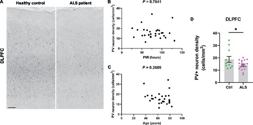 Paucity of PV+ neurons in DLPFC of ALS patients. (A) Immunohistochemistry showing PV+ interneurons in the dorsolateral prefrontal cortex (DLPFC) of neurologically healthy controls and ALS patients. Scale bar, 300 μm. (B) Scatter plot demonstrating PV+ interneuron density versus post mortem interval for each case (cases and controls combined). (C) Scatter plot demonstrating PV+ interneuron density versus age of each patient (cases and controls combined). D Quantification of PV+ interneuron density (cells/mm2) in DLPFC: * P = 0.0447. Each dot represents one case. Groups were compared by unpaired two-tailed t-test: Error bars represent mean ± SEM.