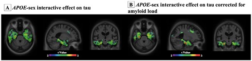 Voxel-based interaction analyses revealed that APOE-by-sex interactive effect was associated with tau load in medial temporal regions.APOE-by-sex interactive effect was significantly associated with tau load in medial temporal regions. Images represent voxel-based t-statistical parametric maps (corrected for multiple comparisons; cluster threshold of P < 0.001) overlaid on the structural MRI ADNI reference template. Age, educational attainment and clinical diagnosis were used as covariates in the models. Analyses performed with and without correction for amyloid were presented in B and A, respectively.