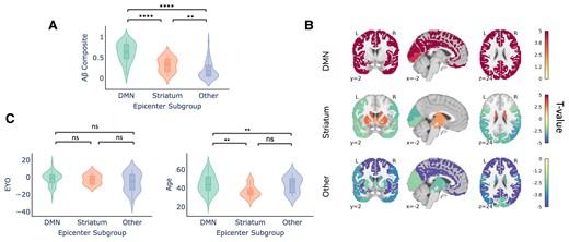 Demographic differences across epicentre subgroups in DIAN (only amyloid-beta positive individuals). (A) Within-subject amyloid-beta composite signal across the epicentre subgroups. (B) Comparison of whole-brain amyloid-beta signal across the epicentre sub-groups. Regions are colour-coded based on their t-value for the particular group, with red indicating that there is more amyloid-beta signal in the respective group compared with the other two groups. (C) Within-subject EYO and age differences across the epicentre subgroups were compared using a Mann–Whitney–Wilcoxon test. There were no significant differences for age whereas the DMN group was significantly older than the striatum and other group (DMN versus striatum: U = 1091, P = 0.003; DMN versus other: U = 2089, P = 0.005 two-tailed with Bonferoni correction).