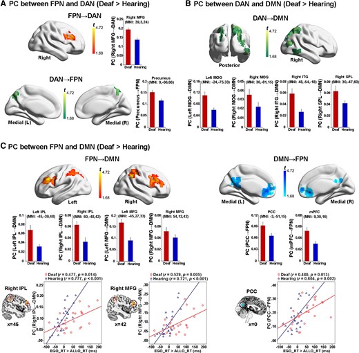 Nodal-wise results of intrinsic neural activity during the resting state. (A) Both the right MFG in the FPN (top panel) and the precuneus in the DAN (bottom panel) showed a significantly higher PC with the other task-critical network in the deaf than hearing group. (B) Extensive regions in the DAN showed significantly higher PCs to the DMN in the deaf than hearing group. (C) Left panel: the bilateral IPL and the bilateral MFG in the FPN showed significantly higher PCs to the DMN in the deaf than hearing group. Especially, the PCs in one right IPL and one right MFG cluster in the FPN significantly correlated with the egocentric performance in both groups. Right panel: the PCC and mPFC in the DMN showed significantly higher PCs to the FPN in the deaf than hearing group. Moreover, the mean PC value in a PCC cluster significantly correlated with the egocentric performance in both groups. For demonstration purposes, the mean PCs were extracted in the significantly activated regions and shown as a function of the two groups. No further statistical analysis was performed on the extracted PCs to avoid double-dipping. Error bars represent SEs.