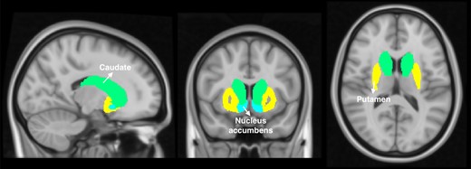 Binge regions consisted of the bilateral caudate, putamen and nucleus accumbens according to the Harvard-Oxford subcortical structural atlas as implemented in conn.