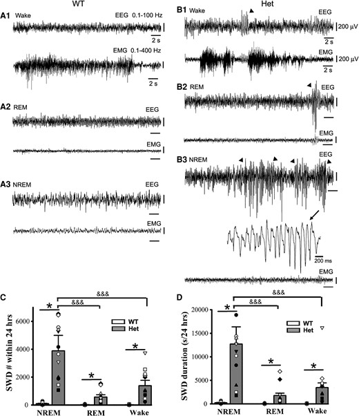 Epileptic SWD incidence prefers NREM sleep period to REM sleep and wakeful state in het Gabrg2+/Q390X KI mice. Panels A/B show representative EEG/EMG traces (30 s) for wake and REM/NREM sleep periods whose power spectrograms are indicated in Fig. 1A/B in one wt littermate and one het KI mouse. In panel B, SWDs are indicated by arrowheads and one SWD is expanded with a smaller temporal scale in panel B3. All scale bars are labelled as indicated. Panels C/D show summary data for SWD incidence and duration during NREM/REM sleep and wake periods (continuous 24 hrs recordings) for wt n = 9 (male 1, female 8) and het n = 12 (male 6, female 6) mice. * indicates significance with P < 0.05 by using t-test between wt and het in NREM or REM or wake groups and &&& one-way ANOVA significance with P < 0.05 between NREM, REM and wake groups in het mice (also see result section).