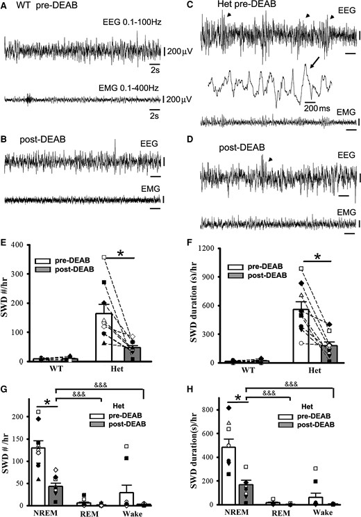 Suppression of SWO-induced homeostatic synaptic potentiation by DEAB decreases epileptic SWD incidence in het Gabrg2+/Q390X KI mice. Panels A/B show representative pre-DEAB and post-DEAB EEG/EMG traces (30 s) in one wt littermate. Panels C/D show representative pre-DEAB and post-DEAB EEG/EMG traces (30 s) in one het KI mouse. SWDs are indicated as arrowheads, and one SWD is expanded with a smaller temporal scale in panel C. All scale bars are labelled as indicated. Panels E/F show summary SWD incidence and duration data for wt littermates (n = 7, male 5, female 2) and het KI mice (n = 9, male 2, female 7). Panels G/H show summary pre-DEAB and post-DEAB SWD incidence and duration data from het KI mice during NREM/REM/wake period. * indicates paired t-test significance with P < 0.05 between pre-DEAB and post-DEAB in panels E–H (also see result section). One-way ANOVA was tested for pre-DEAB (not shown) or post-DEAB (shown) NREM, REM and wake period for panels G and H, with significance &&& P < 0.00001.