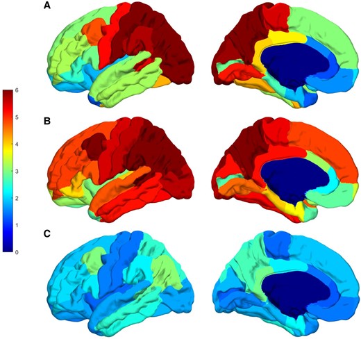 SUVRs for flortaucipir PET in persons affected by autosomal dominant Alzheimer’s disease mutations. The averaged SUVR for both cerebral hemispheres shown on the left hemisphere of the fsaverage template from all subjects in each group. For each subject, SUVR value was first averaged for each region of interest and then left and right hemispheres were averaged shown here on the fsaverage template for each group. The top row (A) is data from the two brothers affected by the F388S mutation, the middle row (B) is derived from seven persons affected by the A431E mutation in PSEN1, and the bottom row (C) is derived from three persons affected by autosomal dominant Alzheimer’s disease mutations that do not cause spastic paraparesis. Note the variable involvement of the Rolandic cortex associated with presence or absence of SP but consistent involvement of the precuneus across groups.