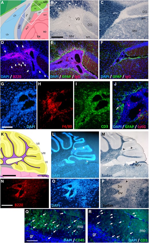 Demyelination and inflammation in the brain of e1-immunized female mice. (A) Schematic forebrain area (white square) used for B–J. Mouse atlas reference image 19, P56, sagittal (obtained from the Allen Institute website at www.alleninstitute.org); scale bar, 180 µm. (B–C) Black Sudan myelin stain showing patches of demyelination (arrowheads) of a symptomatic mouse (B) versus a control mouse (C). (D) DAPI stain (blue) with B220-immunoreactivity (red) showing periventricular B cell enrichment in the leptomeninges of a symptomatic mouse. Few B220 + cells also invade the bordering thalamus and stria medullaris (arrows). (E–F) DAPI stain with GFAP-immunoreactivity (green) and IgG-immunoreactivity (red) from a symptomatic mouse (E) versus limited IgG detection in a control mouse (F). Scale bar B–F, 180 µm. (G–I) DAPI stain (G) with F4/80-immunoreactivity (H) and CD3-immunoreactivity (I) from a symptomatic mouse in the V3 area. (J) DAPI stain and Ly6G-immunoreactivity (red) showing limited granulocyte infiltration (arrow) in the GFAP-immunoreactive (green) parenchyma. Scale bar G–J, 80 µm. (K) Schematic cerebellar area used for L–R. Reference Atlas image 16, P56, sagittal. (L–M) DAPI (L) and myelin (M) stains showing lobule demyelination (arrowheads) of a symptomatic mouse. Scale bar K–M, 800 µm. (N–P) White matter perivascular infiltration, magnification fields with B220-immunoreactivity (N), DAPI (O) and myelin (P) stains. Scale bar N–P, 80 µm. (Q–R) Immune cell infiltration (arrows) in cerebellar molecular layer revealed by (Q) DAPI/CD45-immunoreactivity (green) or (R) DAPI/CD3-immunoreactivity (green). Scale bar Q–R, 80 µm. Legends: bv, blood vessels; DG, dentate gyrus; gr, granule layer; lfu, lateral funiculus; m, meninges; MH, medial habenula; mo, molecular layer; pcl, Purkinje neuron layer; sm, stria medullaris; sptV, spinal trigeminal tract; vhc, ventral hippocampal commissure; V3, third ventricle. See Supplementary material file for corresponding separate channel images when required.