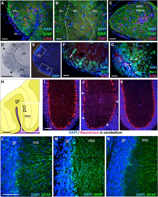 Neuroinflammation in the spinal cord, optic nerve and cerebellum in e1-immunized female mice. (A–G): Immune cell infiltration in the spinal cord parenchyma (A–B) or optic nerve (C) revealed by CD45-immunoreactivity (red), GFAP-immunoreactivity (green) and DAPI (blue). The dashed lines separate the grey and white matter in B. Scale bar A–C, 40 µm. (D–E) Myelin (D) and DAPI (E) stains showing spots (arrowheads) of perimeningeal demyelination and cell infiltration. Scale bar D–E, 200 µm. (F-G) B220-immunoreactivity (red) and iba-1-immunoreactivity (green) showing limited B cell (arrows) and wider macrophage parenchymal infiltration. Scale bar F–G, 40 µm. Legends: dfu, dorsal funiculus; dh, dorsal horn; lfu, lateral funiculus; m, meninges; vfu, ventral funiculus; vh, ventral horn. (H–N): Alterations in Purkinje cell layer and Bergman fibre integrity in symptomatic e1-immunized mice: (H) Schematic view of a sagittal section of the cerebellum (yellow) used for photograph fields (white box) in I–K. Scale bar, 200 µm. Legends: gr, granule layer; mo, molecular layer; pcl, Purkinje neuron layer; VIII, pyramus lobule. (I–K) DAPI (blue)/Neurotrace (red) staining from a control mouse (I), closed to a dense immune cell infiltrate in the white matter from a symptomatic mouse (J), or from a symptomatic mouse without neuroinflammation in this area (K). Arrowheads indicate Purkinje cell layer disruption. Scale bar for I–K, 80 µm. (L–N) Bergman fibres stained for GFAP (green) and DAPI stain (blue) from a control mouse (L), close to a dense immune cell infiltrate in the white matter from a symptomatic mouse (M), or from the same mouse but within an unaffected lobe (N). Scale bar for L–N, 80 µm. See Supplementary material file for corresponding separate channel images when required.