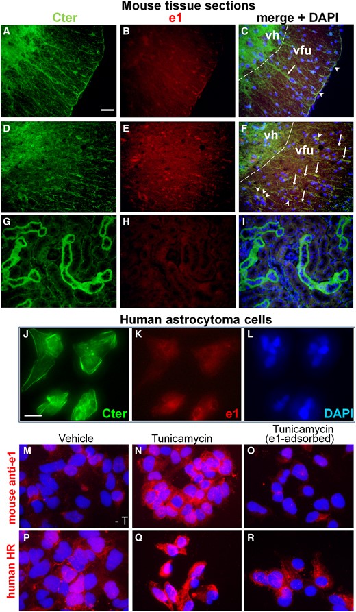 Increased e1 immunoreactivity in MOG35-55-induced EAE and astrocytoma cells. (A–F): Spinal cord sections from control or MOG35-55-induced EAE paraformaldehyde-perfused female mice. First column, anti-Cter Kir4.1 immunoreactivity. Second column, immunoreactivity with the mouse anti-e1 serum. Third column, corresponding merge fields with DAPI stain. (A–C) In control mouse spinal cord, few astrocytic radial fibres were immunoreactive with the commercial antibody but not labelled with anti-e1 serum (arrows) whereas few pial fibres were stained with both anti-Cter and anti-e1 serum (arrowheads). (D–F) In the WM of the inflamed spinal cord of female mice with MOG35-55-induced EAE, numerous radial fibres immunoreactive with anti-Cter (arrows) and cells with oligodendrial morphology (arrowheads) are immunoreactive with the anti-e1 serum. Dashed line indicates the boundary between ventral horn (vh) and ventral funiculus (vfu). In the grey matter, diffuse Cter immunoreactivity corresponding to astroglial network is observed while only a non-specific staining is observed on few neuronal nuclei with the anti-e1 serum. When primary rabbit or mouse antibodies were omitted, no green or red signal was seen in white matter at the exposure time used (not shown). (G–I) On kidney sections from a control paraformaldehyde-perfused mouse, tubules are highly labelled with the Cter antibody (G) but not with the mouse anti-e1 serum (H). Scale bar for A–I, 40 µm. (J–R): Kir4.1 immunoreactivities in U-251 astrocytoma cells. (J–L) Representative immunostainings of untreated cells showing anti-Cter Kir4.1 immunoreactivity (J) versus anti-e1 reactivity (K) and corresponding DAPI stain (L). (M–O) Immunoreactivity obtained with mouse anti-e1 serum (red) and DAPI stain in untreated (M) versus tunicamycin-treated (N) cells, and with e1-preadsorbed mouse antiserum on tunicamycin-treated cells (O). (P–R) Immunoreactivity obtained with human HR serum (red) and DAPI stain in untreated (P) or tunicamycin-treated (Q) Cells, and with e1-preadsorbed mouse antiserum on tunicamycin-treated cells (R). Scale bars A–I, J–R: 50 µm.
