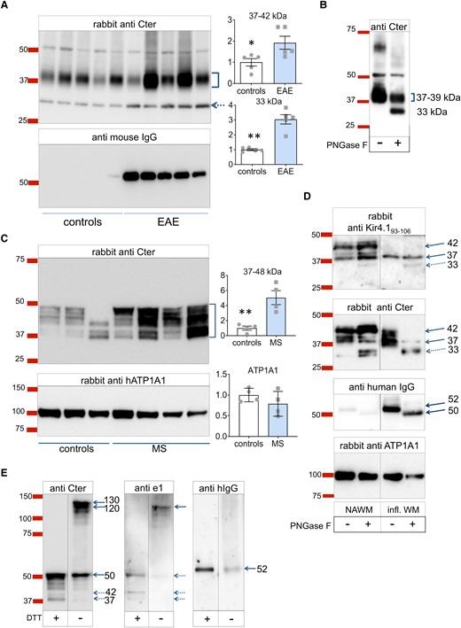 Kir4.1 molecular forms revealed by Western blot. (A) Kir4.1 detection in reduced denaturing conditions with spinal cord membrane extracts from MOG35-55 EAE mice or their controls. Top: anti-Cter detection (overnight primary antibody incubation, 15 s exposure) with densitometry relative to controls. Two-tailed unpaired t-tests, controls (PBS/CFA treated, n = 5 mice) versus MOG35-55 induced EAE (n = 5 mice): *, P < 0.05 (t = 2.618, df = 8) ; **, P < 0.01 (t = 6.363, df = 4.293 with Welsh correction); Bottom, mouse IgG detection revealing the glycosylated heavy chain subunit (52 kDa, ) in EAE samples. Ea (B) WB (reduced denaturing conditions) with mouse spinal cord membrane extracts subjected or not to overnight PNGase digestion (anti-Cter detection after 1 h primary incubation). (C) Kir4.1 detection in reduced denaturing conditions using human white matter membranes from controls (n = 4 individuals) and WM active multiple sclerosis lesions (MS, n = 4 individuals). Top, rabbit anti-Cter. Controls versus MS, two-tailed unpaired t-test: **, P < 0.01 (t = 4.195, df = 6); Bottom, rabbit anti-human ATP1A1. (D) WB from white matter membrane extracts of a control NAWM versus a highly inflamed sample processed or not for overnight PNGase digestion. Detection with rabbit anti-Kir4.193-106 (femto detection), rabbit anti-Cter Kir4.1356-375, anti-human IgG, and rabbit anti-human ATP1A1. Western blot for human IgGs confirmed the high IgG content of the inflamed WM and the deglycosylation effectiveness of the heavy chain from 52 to 50 kDa by PNGase whereas the size of the ATP1A1 band was unaffected. (E) Comparison of Kir4.1 detection using reduced (+ DTT) versus unreduced (− DTT) denaturing conditions from a multiple sclerosis sample. The membrane was probed with mouse anti-e1 serum, rabbit anti-Cter antibody, and anti-human IgG. See Supplementary material file for corresponding uncropped blot images.