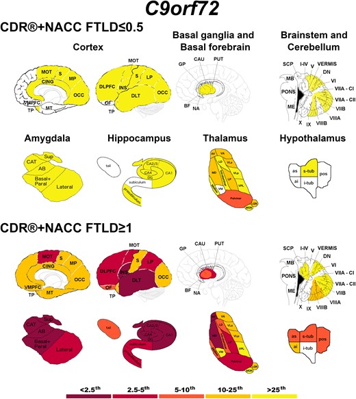 Pattern of grey matter involvement in C9orf72 for the stages defined by CDR®+NACC FTLD global scores. The color map indicates the percentile corresponding to the mean w-scores in each group (C9orf72 ≤ 0.5/≥1: n = 113/47), when these were statistically abnormal (i.e. significantly different from 0, t-test) when compared to controls (n = 240).