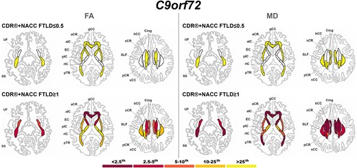 Pattern of white matter involvement in C9orf72 for the stages defined by CDR®+NACC FTLD global scores. FA indexes are reported on the left side of the figure, while MD on the right. The color map indicates the percentile corresponding to the mean w-scores in each group (C9orf72 ≤ 0.5/≥1: n = 113/47), when these were statistically abnormal (i.e. significantly different from 0, t-test) when compared to controls (n = 240).