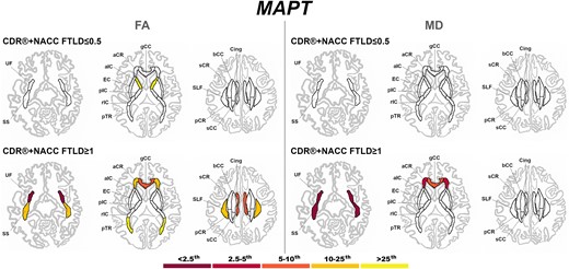 Pattern of white matter involvement in MAPT for the stages defined by CDR®+NACC FTLD global scores. FA indexes are reported on the left side of the figure, while MD on the right. The color map indicates the percentile corresponding to the mean w-scores in each group (MAPT ≤0.5/≥1: n = 52/15), when these were statistically abnormal (i.e. significantly different from 0, t-test) when compared to controls (n = 240).