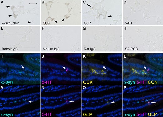Representative images showing α-synuclein and markers of enteroendocrine cells examined by immunohistochemistry in STC-1 cells (A–H) and by immunofluorescence in longitudinal sections of mouse ileum (I–P). Immunoreactivity for (A) α-synuclein (arrows), (the arrowhead shows a neuropod), (B) CCK (arrows) and (C) GLP (arrows). (D) 5-HT staining was not evident in STC-1 cells. No immunoreactivity was detected when primary antibodies were omitted and just biotinylated (E) rabbit, (F) mouse or (G) rat immunoglobulins and streptavidin conjugated with peroxidase (SA-POD) were used or (H) just SA-POD was used. Immunofluorescence for (I and M) α-synuclein (arrow), (J and N) 5-HT (arrow), (K) CCK (arrow) and (O) GLP (arrow). (L) Co-expression of 5-HT, CCK and α-synuclein (arrow). (P) Co-expression of 5-HT, GLP and α-synuclein (arrow). Cellular nuclei were stained with DAPI. The bar in A = 25 μm for A–H and the bar in I = 100 μm for I–P.