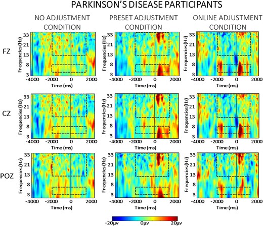 Averaged time-warped spectrograms of representative midline channels (Fz, Cz and POz) in the Parkinson’s disease group across conditions. The vertical black lines on the left (around −3000 ms) represent the start of the trial; the vertical black line (at 0 ms) represents the obstacle crossing event. The two black dashed squares in each figure highlight the time and the frequency bands of interest (i.e. theta at 4–7 Hz and beta at 13–35 Hz) in the analysis.