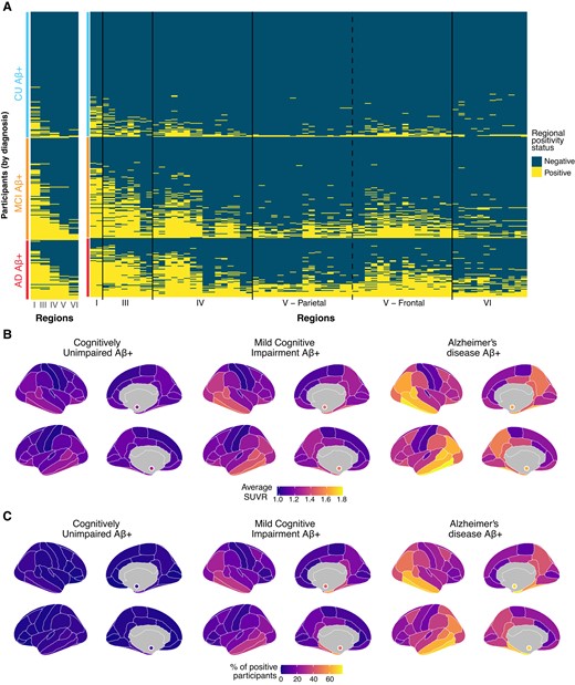 Spatial extent of abnormal tau deposition in amyloid-positive participants of the ADNI cohort. (A) Based on the method discussed in Fig. 1, abnormality thresholds were determined for each I Braak stages (except stage II) and for each II region of the cortical mantle and the bilateral amygdalae (70 regions). One row on the heatmap corresponds to an individual participant, while each column represents a distinct cortical region. Within each diagnostic group, participants were sorted from individuals with the lowest to highest spatial extent index. Regions on the x-axis in II are sorted by Braak stages. (B) Regional average SUVR, by diagnostic status. (C) Brain maps representing the percentage of participants having abnormal levels of tau in each region, by diagnostic status.
