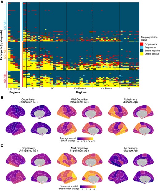 Spatial localization of abnormal tau accumulation over time in amyloid-positive participants of the ADNI cohort. (A) Abnormal accumulation is presented by (I) Braak stages and (II) all 70 individual brain regions of the Desikan atlas. Colours denote the change in the region between the baseline and the last available visit. A stable region (negative or positive) did not change status during the follow-up. A progressing region was originally negative and subsequently became positive over time. A regressing region was originally positive and became negative over time. (B) Brain maps presenting the average SUVR change per region per year. (C) Brain maps representing the percentage of participants becoming tau-positive in each region annually. In both B and C, values in the bilateral amygdalae are represented by small coloured circles in the medial view of the brain, and the annual change is calculated in each region using linear mixed-effect models with random slopes and intercepts. Only participants with at least three tau scans (n = 100) were kept for B and C to ensure a constant sample across the longitudinal follow-ups.