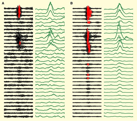 Data analysis examples. Filtred (80–500 Hz) EEG (black) with superimposed HFO detections (red overlay) show how neighbouring channels often had high frequency discharges that did not cross threshold for the HFO detector but were still part of the network spread. In order to remove the effect of oscillatory phase and standardize the time of onset, cross-correlation analysis was performed on the root-mean-squared filtered data (green panels to right). (A) ‘Sample’ with a network discharge that had detected HFOs in three channels, but likely involved at least seven. Note that even in detected channels, the red detection does not accurately detect the onset/offset time of the true discharge. (B) Sample showing network HFO discharge over several channels simultaneously with varying amplitudes.