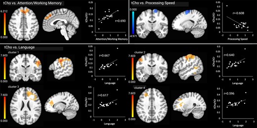 Significant relationships between tCho and the cognitive outcomes. Brain images are shown in neurological convention (left = left). Colour bars indicate t-values from multiple regressions. r-values represent effect sizes (Pearson’s coefficients) for relationships between mean cluster signal and cognitive scores. The x-axis shows cognitive domain Z-scores.
