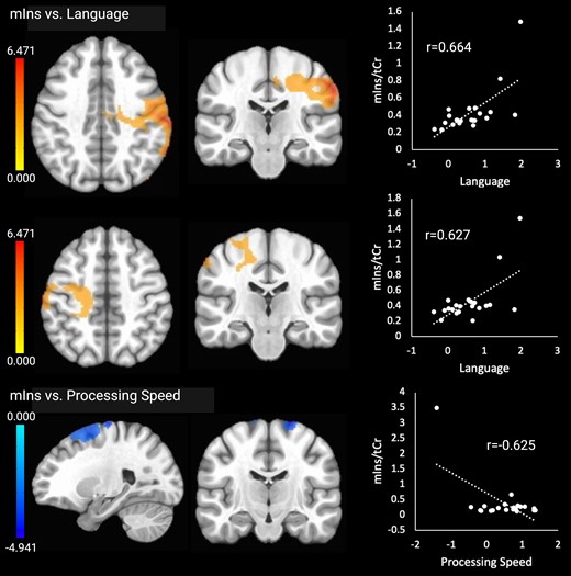 Significant relationships between mIns and the cognitive outcomes. Brain images are shown in neurological convention (left = left). Colour bars indicate t-values from multiple regressions. r-values represent effect sizes (Pearson’s coefficients) for relationships between mean cluster signal and cognitive scores. The x-axis shows cognitive domain Z-scores.