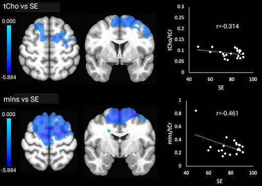 Significant relationships between tCho and mIns and SE. Brain images are shown in neurological convention (left = left). Colour bars indicate t-values. r-values represent effect sizes (Pearson’s coefficients) for relationships between mean cluster signal and SE.