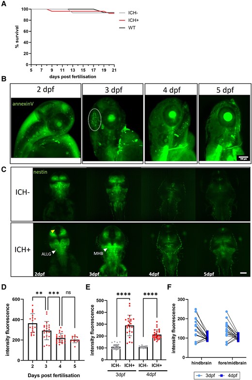 The spontaneous recovery of brain injury after ICH is associated with increased nestin expression. (A) Kaplan Meier analysis shows no difference in survival between WT, ICH− and ICH+ larvae at 21 dpf (93% ICH− and WT, 92% ICH+, N = 35 larvae per group at 5 dpf). (B) Representative images of annexinV expression in an ICH+ larvae at 2, 3, 4 and 5 dpf show apoptotic cells within the head during early development. A dense cluster of dying cells associated with ICH (denoted by white dotted line) at 3 dpf (24 h post-ICH) is resolved by 4 dpf. Scale bar = 100 µm. (C) Representative images of nestin positive larvae from both ICH− and ICH+ groups at 2–5 dpf. Global expression of nestin in the developing larval brain is lost over time with the greatest reduction in expression between 2 and 3 dpf. Overall, ICH+ larvae show a greater intensity of nestin expression. Yellow arrow denotes the absence of nestin expression between hemispheres and white arrows denote regions of intense expression of interest. Scale bar = 100 µm (n = 20, n = 12 at 5 dpf). (D) Quantification of the intensity fluorescence of nestin signal in the brain (n = 12–20). Data were analysed using a one-way ANOVA, **P = 0.0063, ***P = 0.0003, F(3,71) = 19.12. (E) Comparison of nestin expression in the brain at 3 and 4 dpf between ICH− and ICH+ larvae. Data were analysed using a one-way ANOVA ****P < 0.0001, F(3, 110) = 100.9. (F) Paired 3 and 4 dpf data show no difference in brain region of nestin expression. ICH−, intracerebral haemorrhage negative; ICH+, intracerebral haemorrhage positive; WT, wildtype; dpf, days post-fertilisation; ns, non-significant; ALLG, anterior lateral line ganglion; MHB, mid-hindbrain boundary.